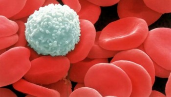 Bệnh LEUKEMIA – Ung thư máu ở trẻ em