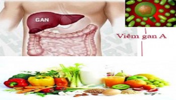 Những kiến thức căn bản nhất về viêm gan A