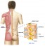 Triệu chứng và cách chữa gãy đốt sống do đè nén